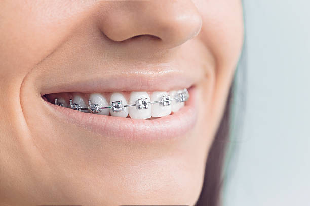 Best Dental Implants  in Zionsville, IN